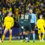 Guardiola rues Man City injury woes after shock loss to Bodo/Glimt